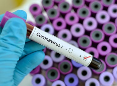 Koronavirüs etiketli tüp
